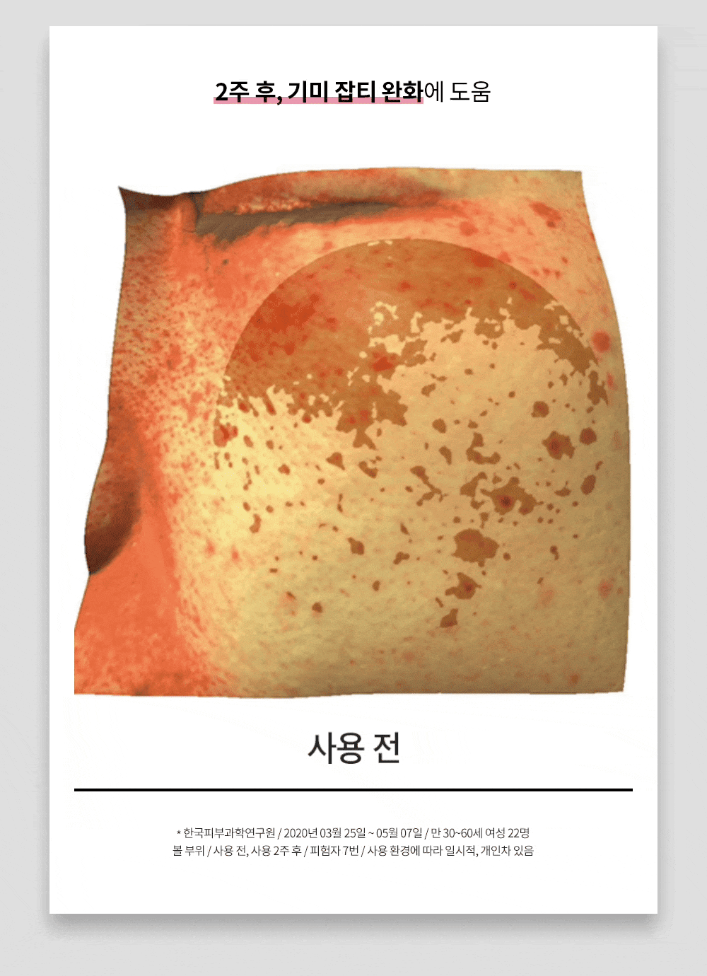 [매니아패키지] 화이트콜라겐 프로그램 16주+1주일분체험분